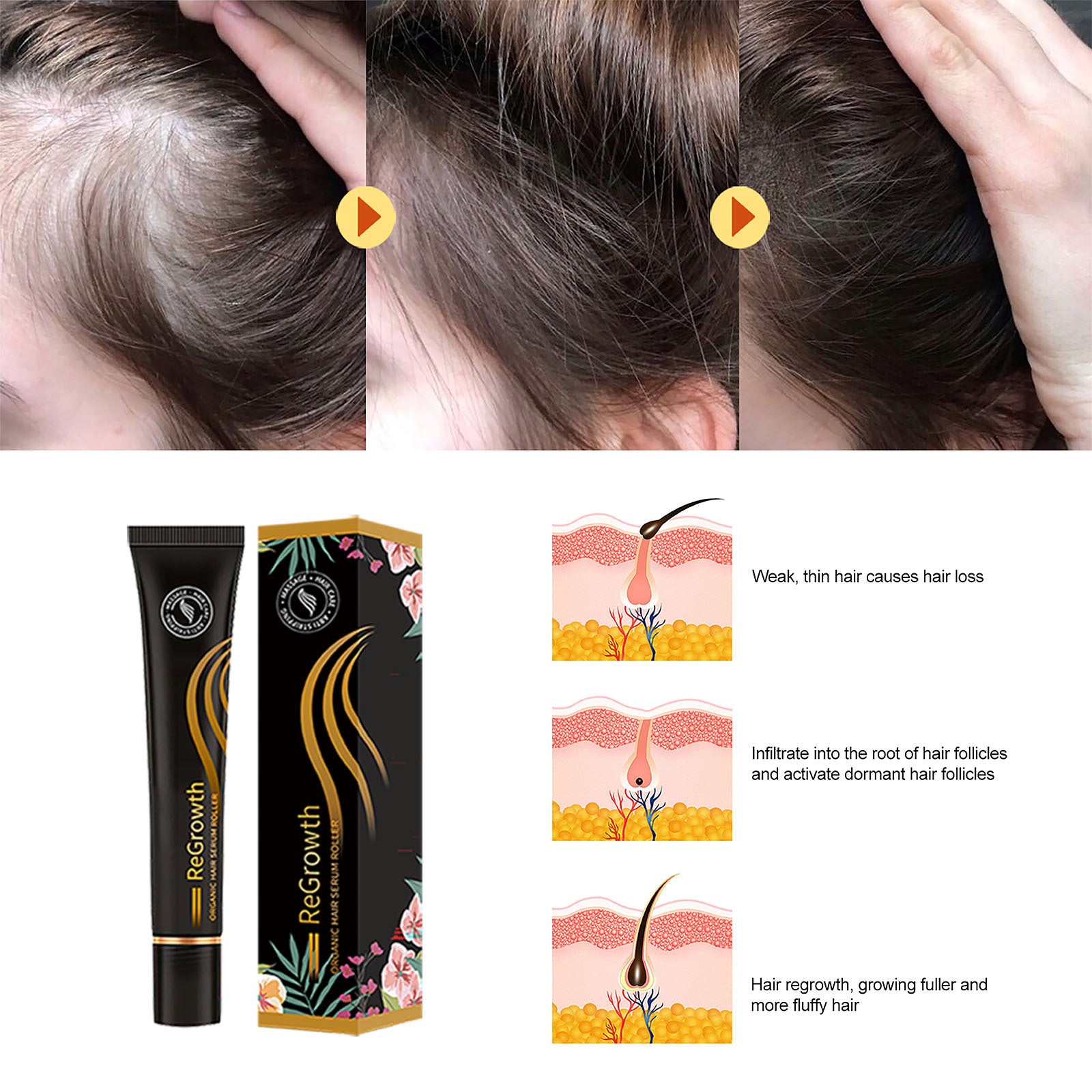 Organic Hair Serum Roller Set | Anti Hair Loss Scalp Nourishing Treatment