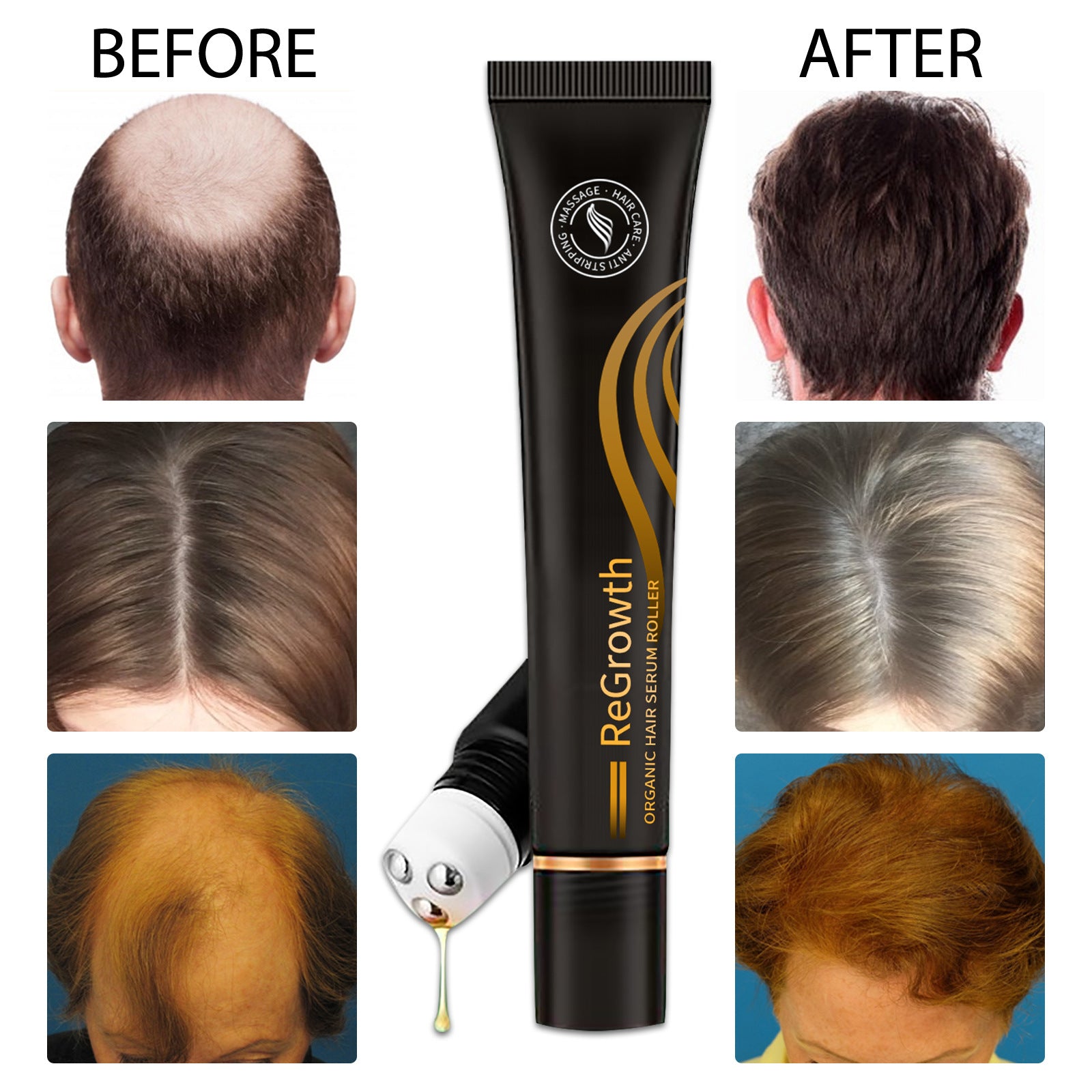 Organic Hair Serum Roller Set | Anti Hair Loss Scalp Nourishing Treatment