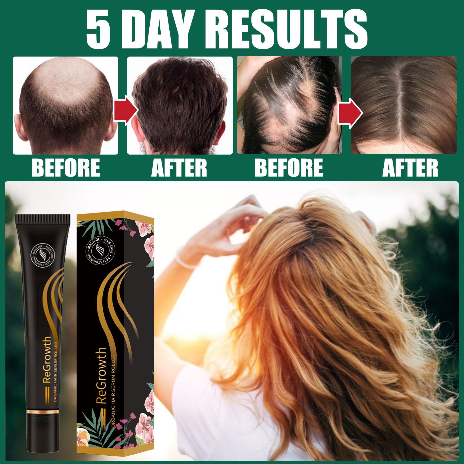 Organic Hair Serum Roller Set | Anti Hair Loss Scalp Nourishing Treatment